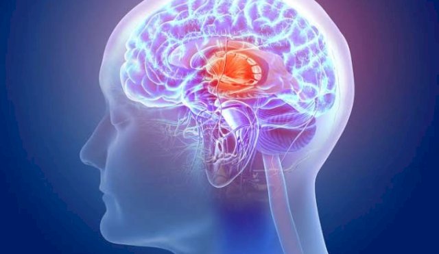 CEREBRO