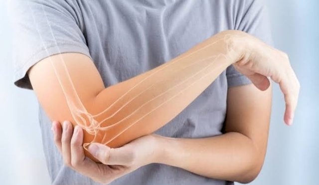 osteoporosis